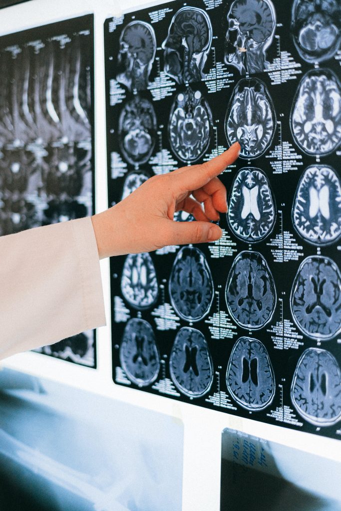 neuropackaging